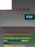 torch (audymay).pptx