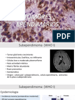 Tumores Ependimarios