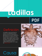 Ladillas