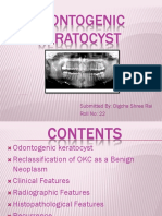 Odontogenic Keratocyst: Submitted By: Digcha Shree Rai Roll No: 22