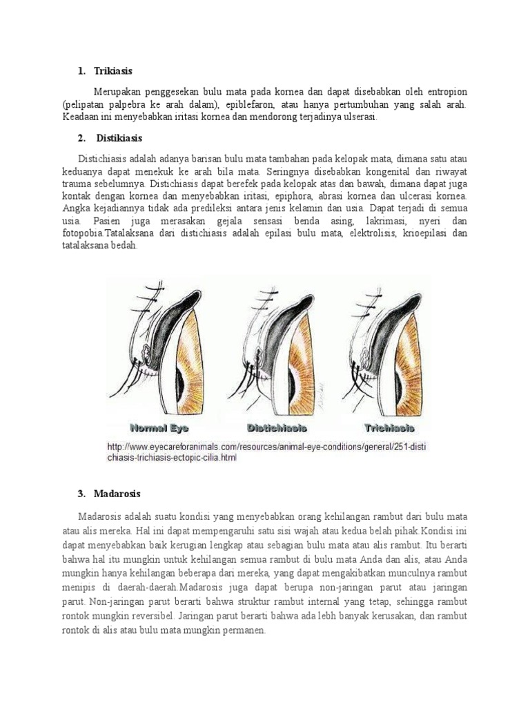 Trikiasis | PDF
