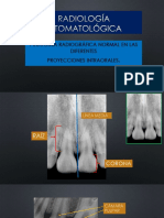 Anatomía Radiografica Intraoral