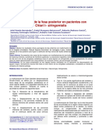 Descompresión de La Fosa Posterior en Pacientes Con Malformación de Chiari