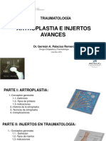 Artroplastia e Injertos