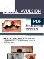 Dental Avulsion: Snya Jindal Intern