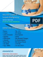 Ascites Grade-Ii Suspek Malignancy: Weekly Meeting