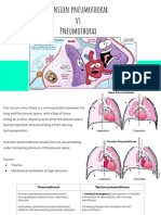 Tension Pneumothorax Vs Pneumothorax