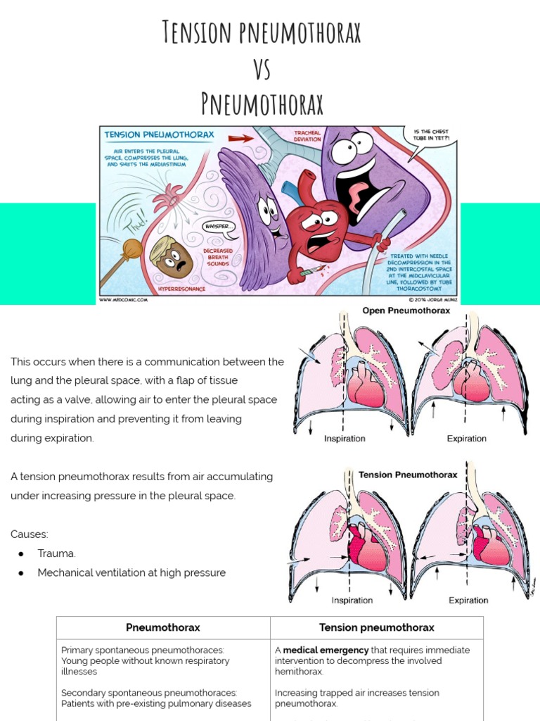 Open Pneumothorax Vs Tension Pneumothorax Chest Trauma | Anesthesia