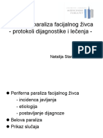 Periferna Paraliza Facijalisa