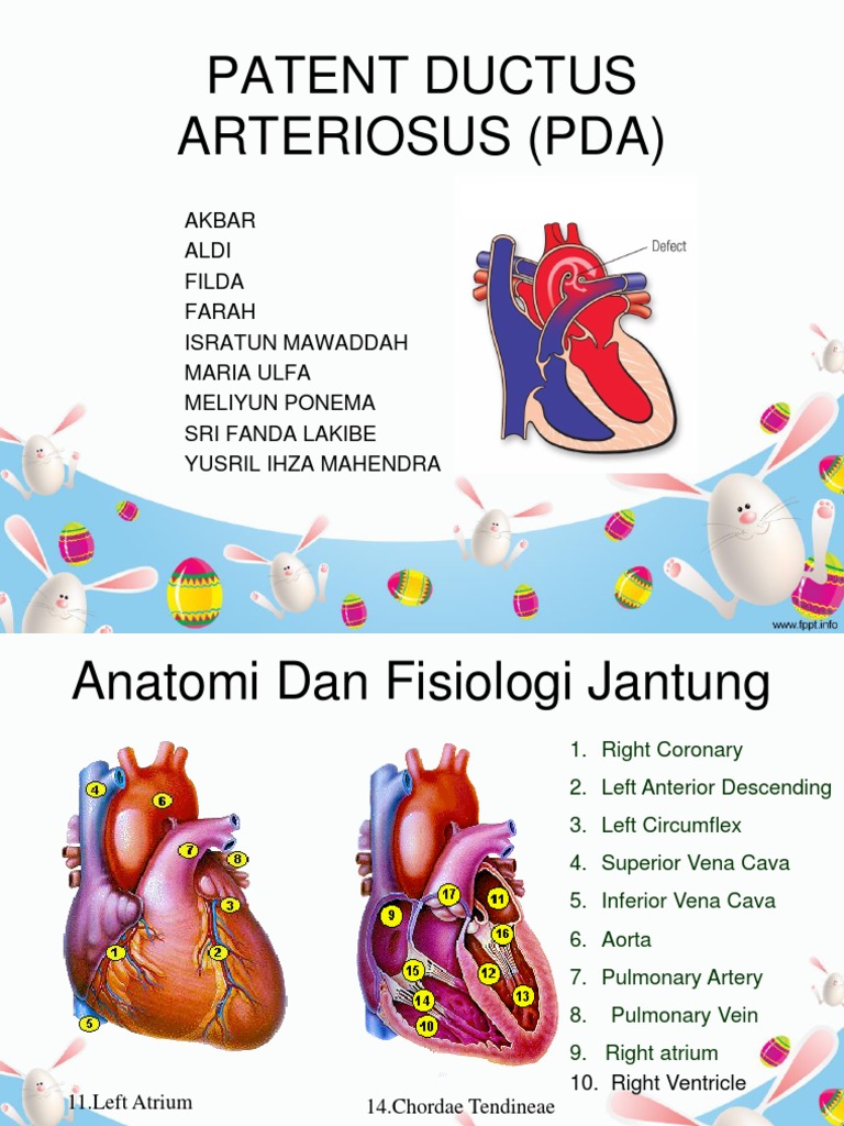 Patent Ductus Arteriosus (Pda) | PDF