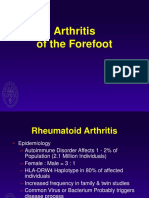 Arthritis of The Forefoot