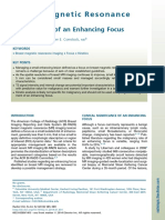 Breastmagneticresonance Imaging: Management of An Enhancing Focus