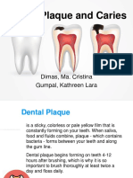 Dental Plaque and Caries: Dimas, Ma. Cristina Gumpal, Kathreen Lara