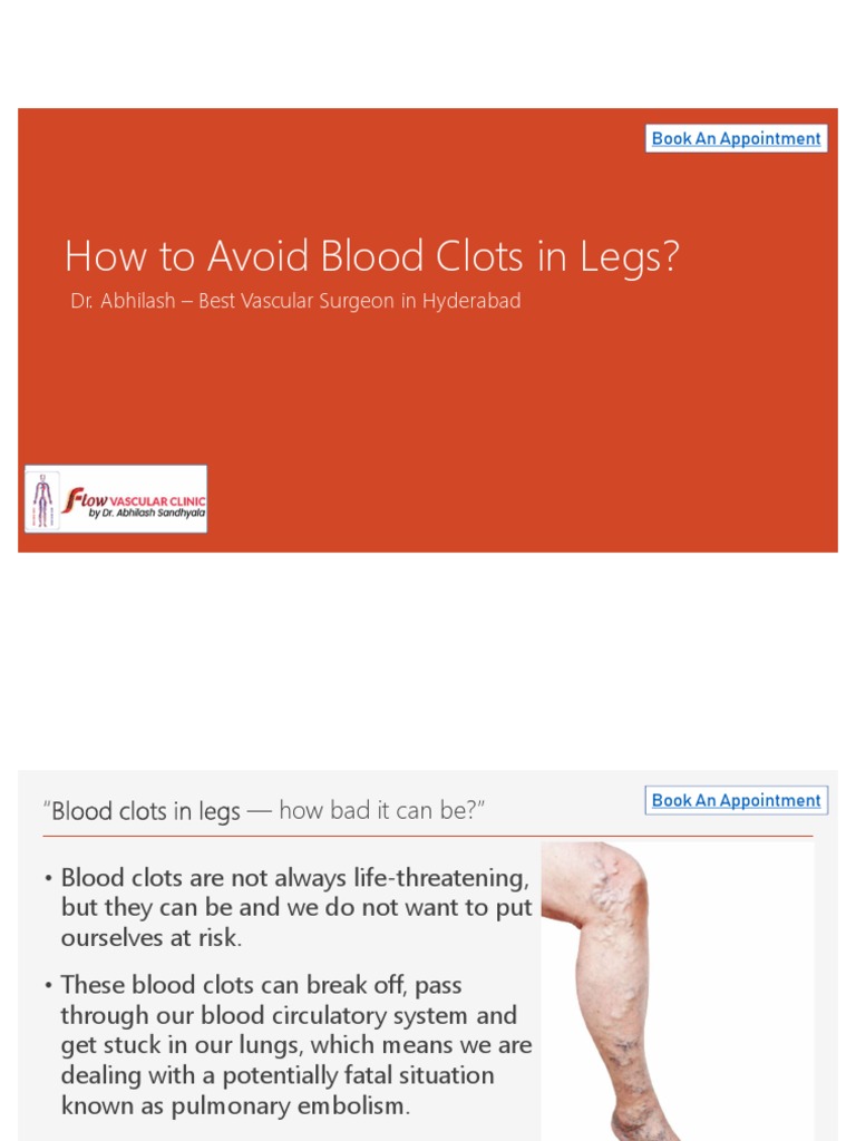 Avoid Blood Clots in Legs PDF Thrombosis Vein