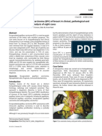 Encapsulated Papillary Carcinoma Breast