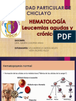Leucemias - Helen