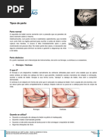 Classificação de Robson: Guia Completo | PDF | Parto | Cesariana