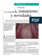 Psoriasis