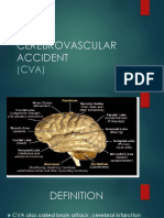 Cerebrovascular Acccident