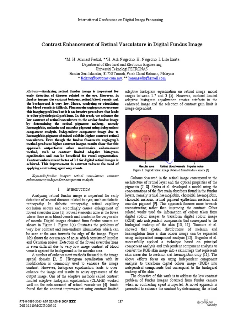 Art14 PDF | PDF | Retina | Human Eye