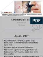 KSB-Karsinoma-Sel-Basal