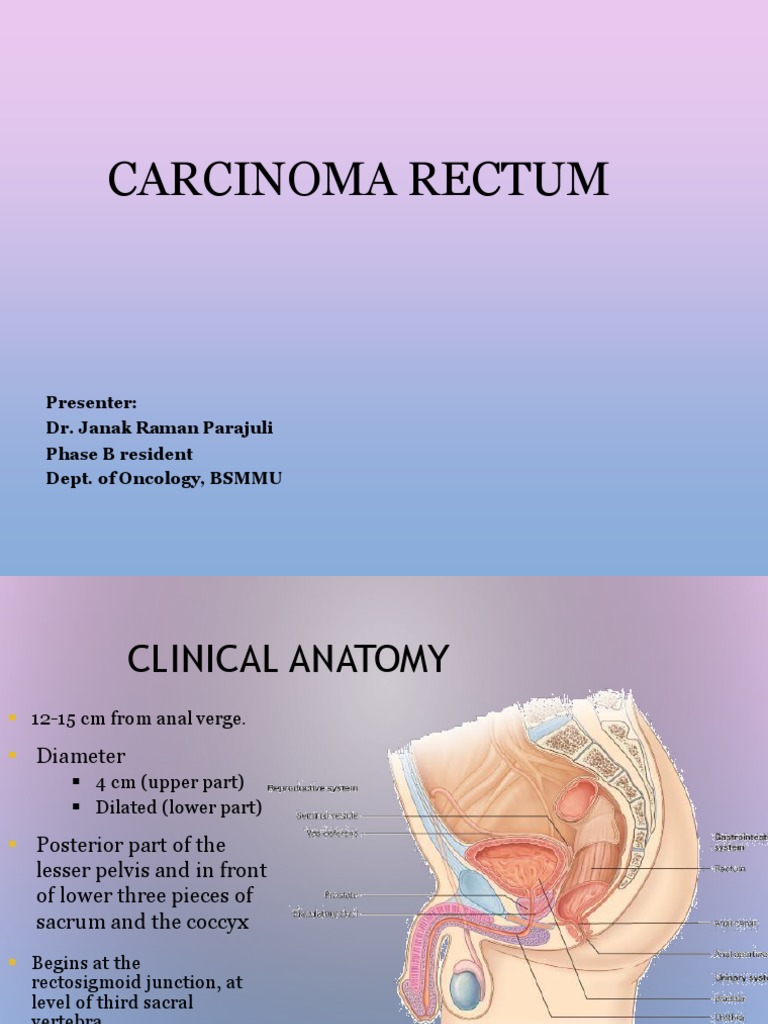 Comprehensive Overview of Rectal Carcinoma | PDF | Rectum | Colorectal ...