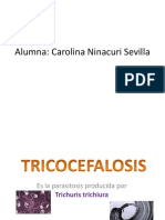 Tricocefalosis Exposición