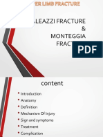 Galeazzi Fracture and Monteggia Fracture