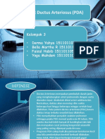 Patent Ductus Arteriosus (PDA)