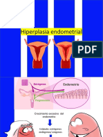 Hiperplasia Endometrial