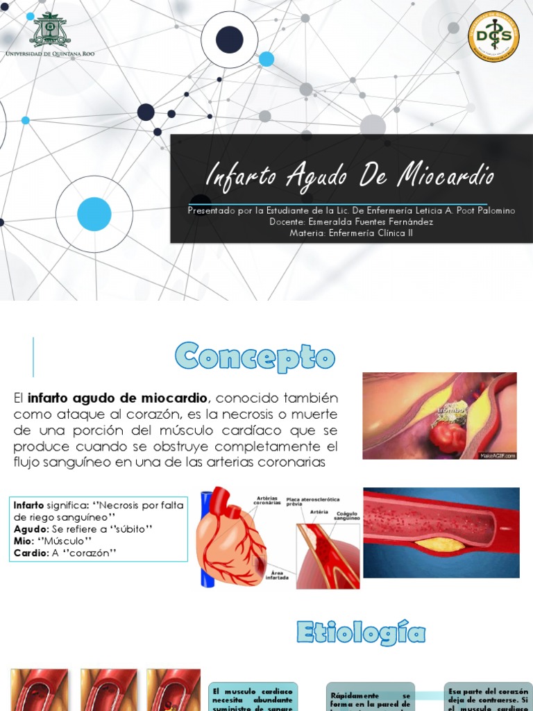 Infarto Agudo de Miocardio: Guía Completa | PDF | Infarto de miocardio ...