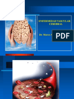 Neurología - ACV