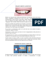 Empaquetamiento Alimenticio y Sindrome Del Diente Agrietado o Fisurado