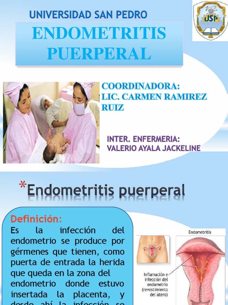Endometritis Puerperal Periodo posparto Dieta