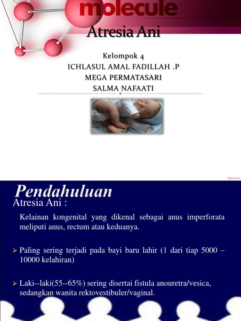 Atresia Ani WK16 | PDF