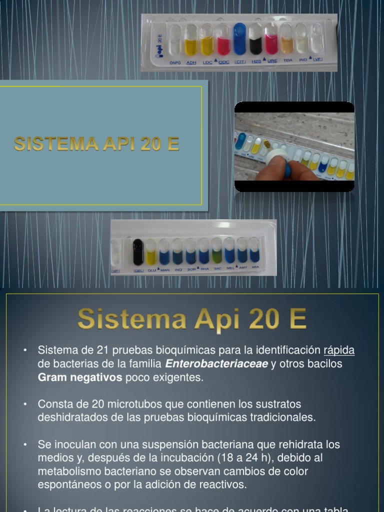 Tira API | PDF | Las bacterias | Organismos