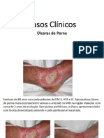 AULA 15 - Casos Clínicos Úlceras de Perna