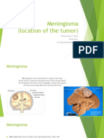 Meningioma