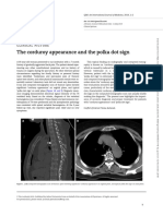 The Corduroy Appearance and The Polka Dot Sign: Clinicalpicture