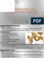 Inter and Sub Trochanteric Fracture