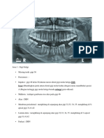 Interpratsi Radiografi