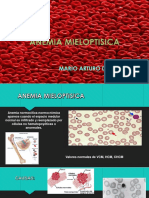Anemia Mieloptisica