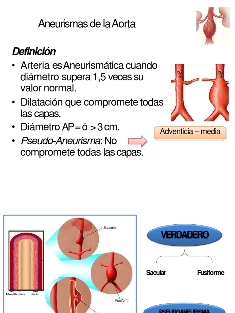 Aneurisma Aortico | PDF | Angiografía | Angiología