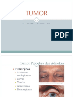 Tumor: Dr. Ardizal Rahman, SPM