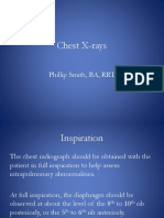 Chest X-rays Explained