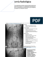 RX Abdomen