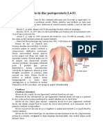 Hernia_de_disc_postoperatorie_L4-S1.docx