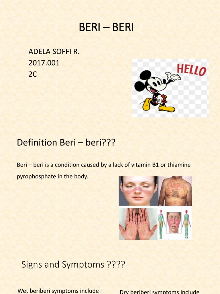 Understanding Beriberi: Causes & Symptoms | PDF | Wellness