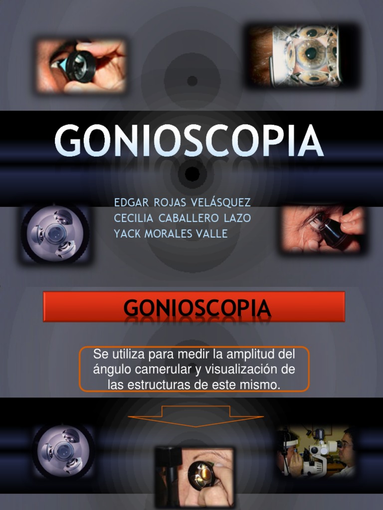 Gonios | PDF | Córnea | Óptica, image size:768x1024