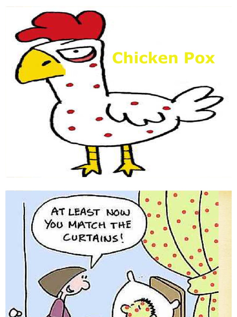 Chicken Pox(Main) | Public Health | Diseases And Disorders